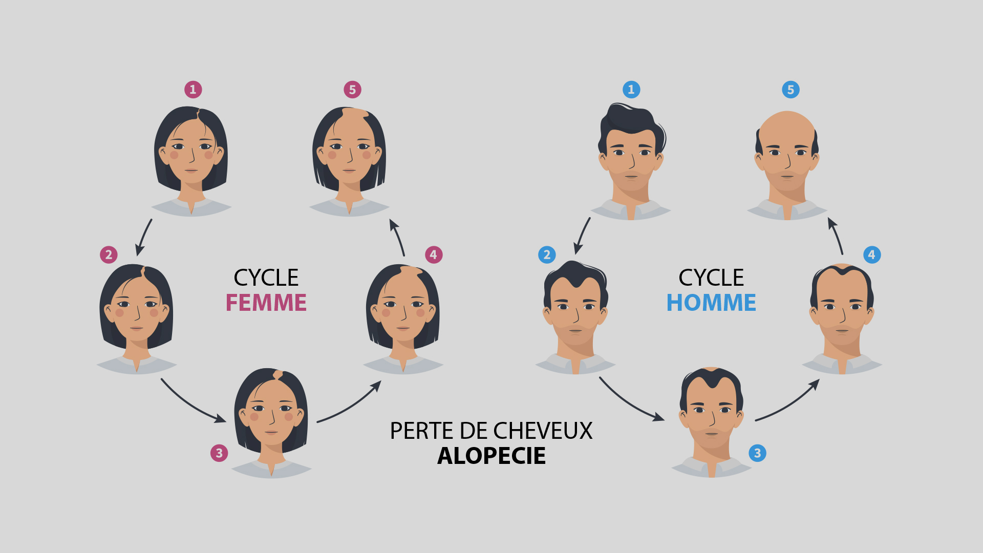 La calvitie et l'hérédité : Comprendre le lien entre l’alopécie et la ...