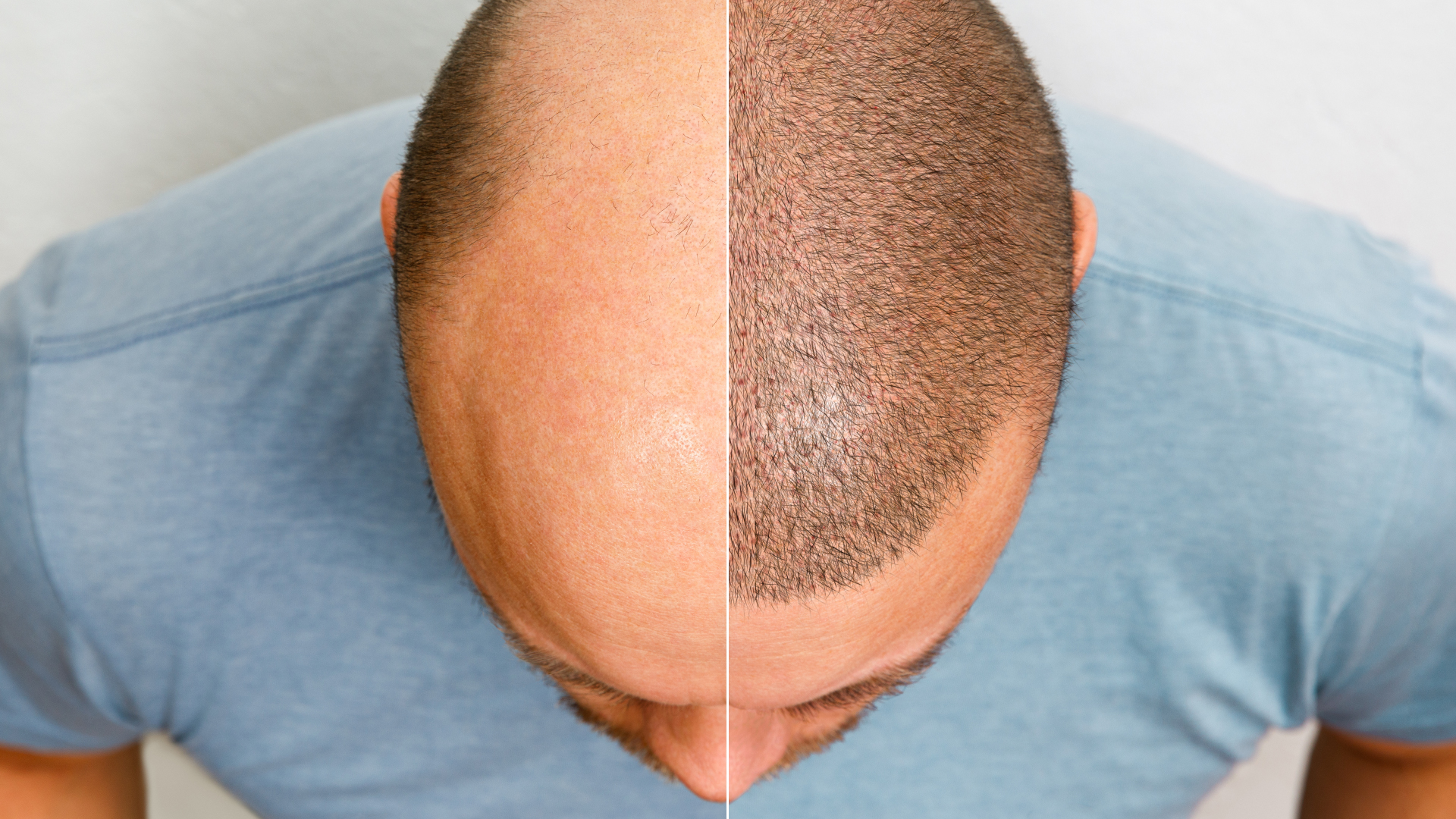 T Shirt Calvitie Precoce Zizi Feroce