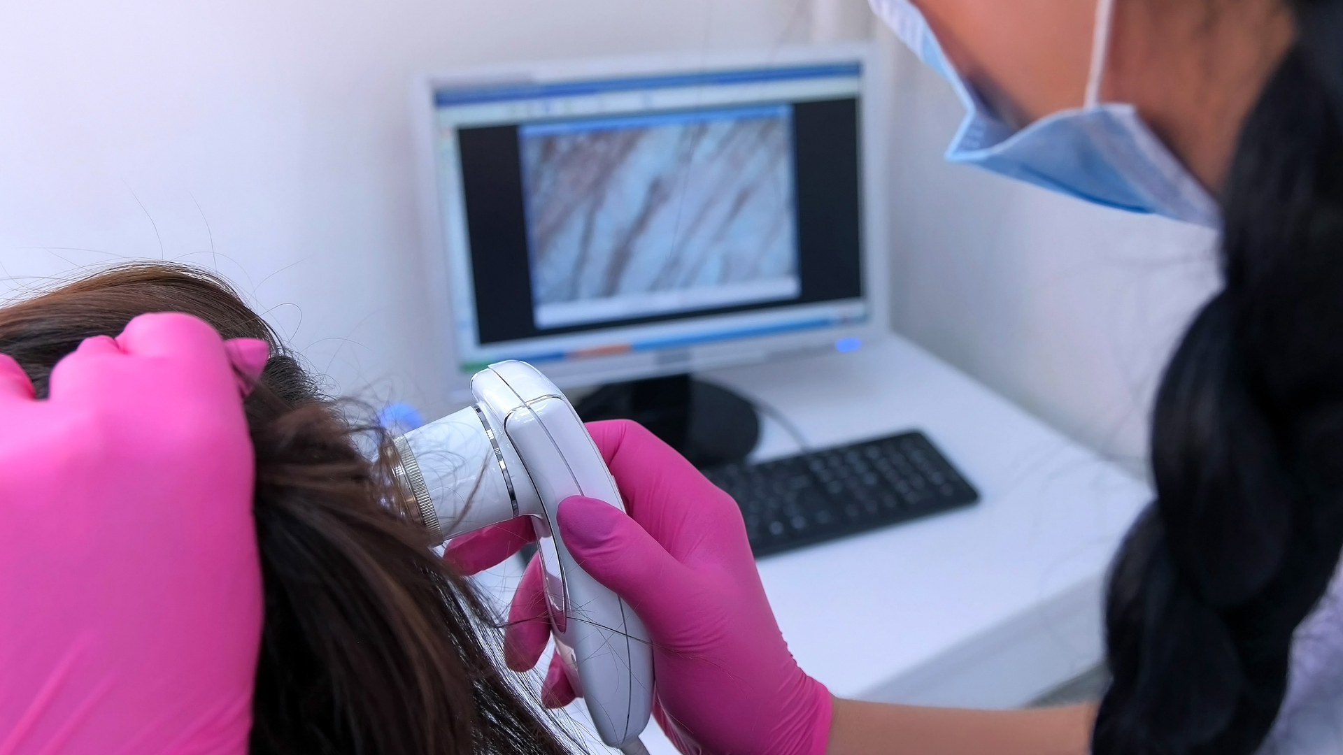 L'analyse du cuir chevelu du patient dans le cadre d'une mesothérapie capillaire