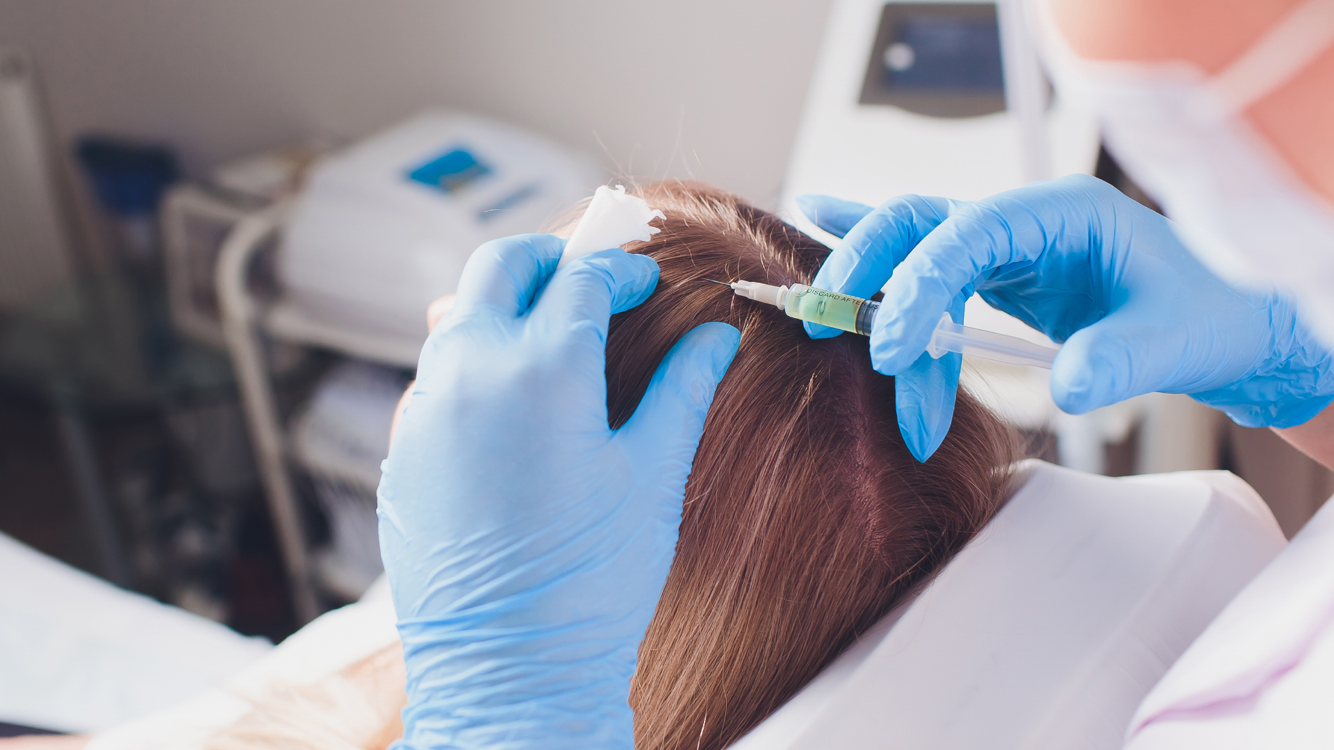 L'injection du lyophilisat dans le cuir cheveulu du patient dans le cadre d'une mesogreffe de cheveux Regenera Activa