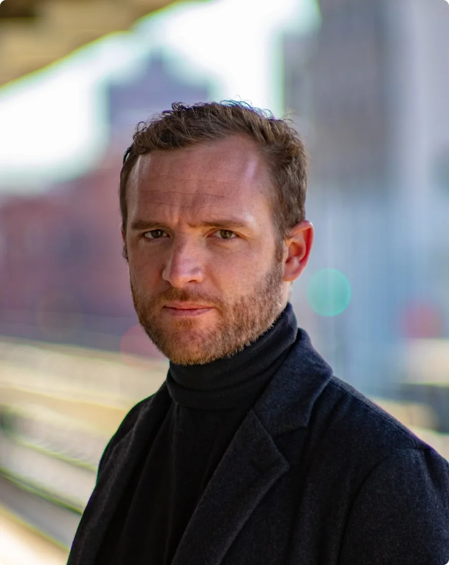 Greffe de Cheveux Ratée