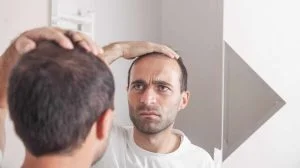 Greffe de cheveux : causes de résistance des cheveux greffés
