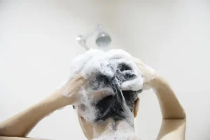 quel shampoing utiliser après une greffe de cheveux