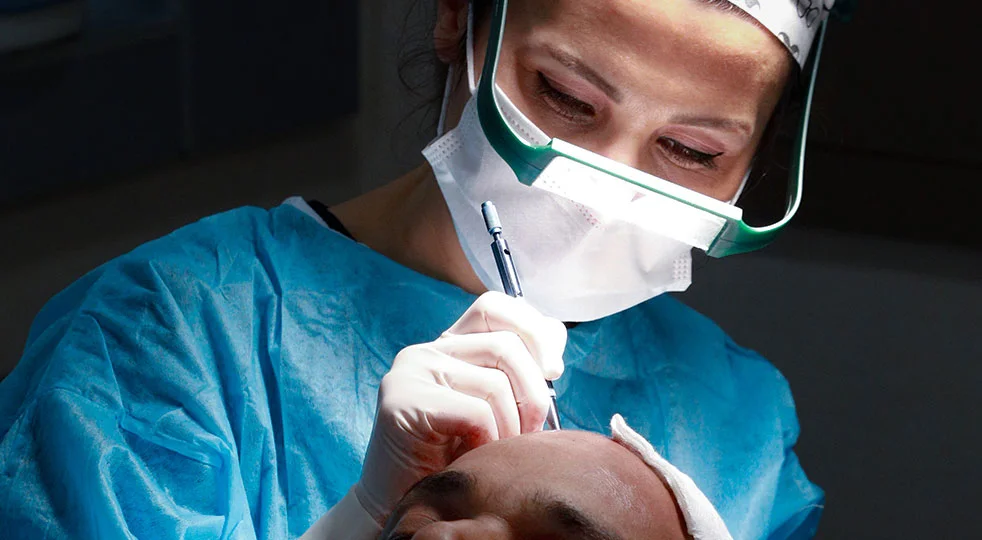 procédure greffe de cheveux