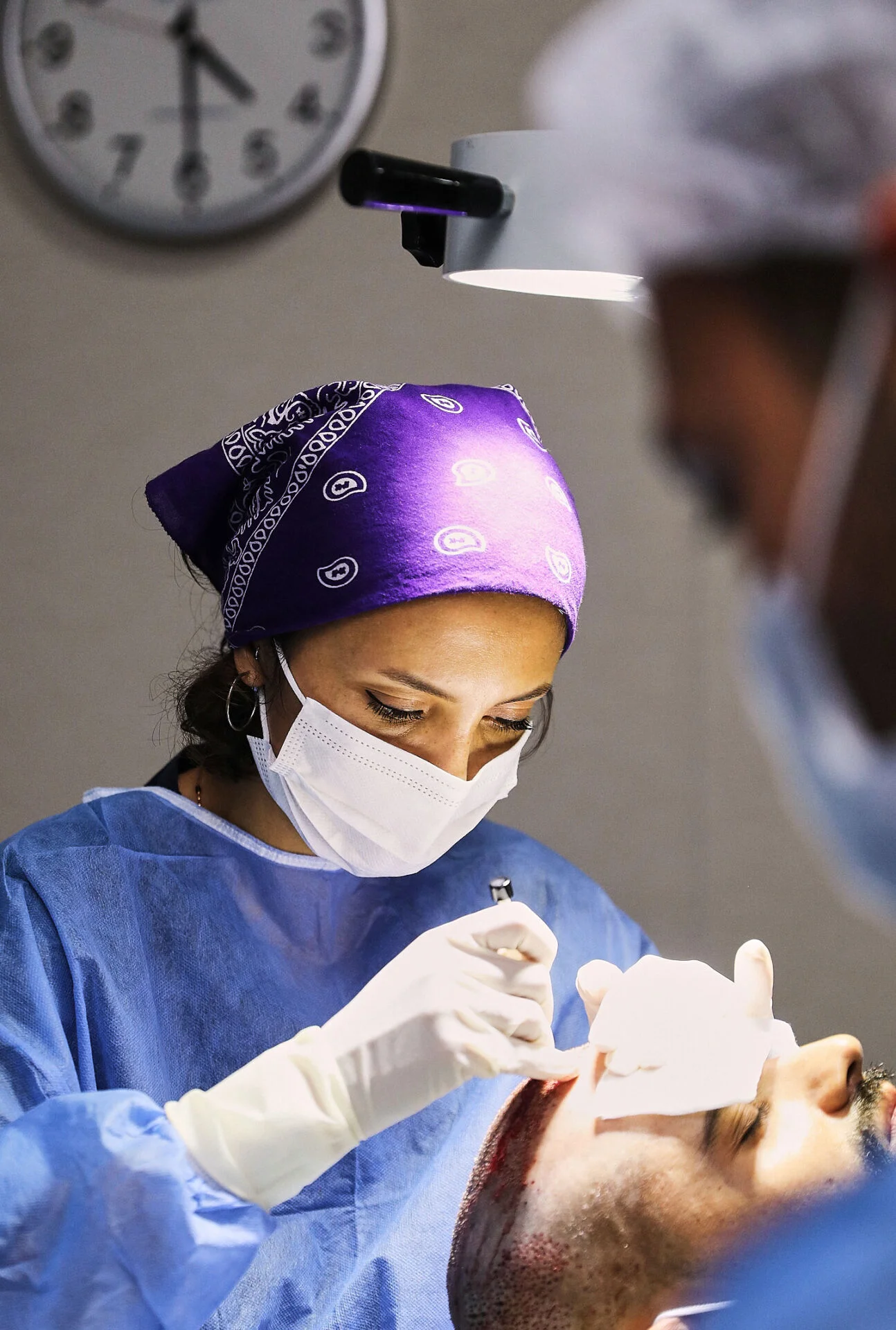 procédure greffe de cheveux