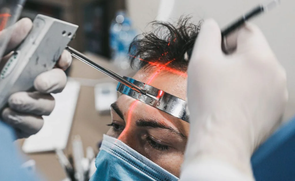 procédure greffe de cheveux